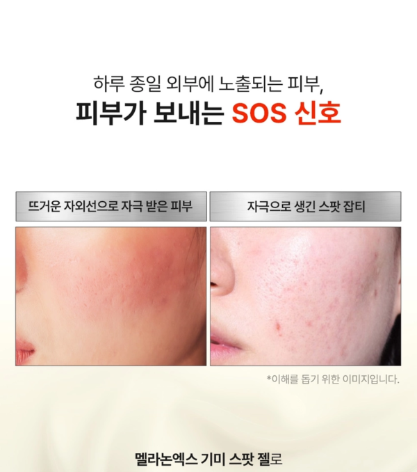 MEDIPEEL MelanonX Dark Spot Gel — 15 ml - Image 4