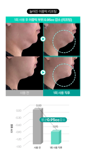 VT PDRN Glow Lifting Mask 27 g + Glow Essence 1.5 ml - Image 9